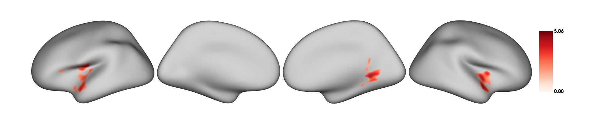 Significant clusters for effect of sex on cortical thickness